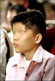 เหยื่อฝนเหลืองในเวียดนามผลพวงจากสงครามเวียดนาม