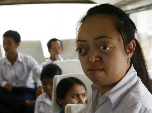 เหยื่อฝนเหลืองในเวียดนามผลพวงจากสงครามเวียดนาม