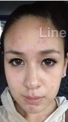 รอบหน้าสด
