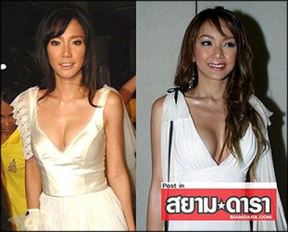 ซุปตาร์ประชันชุดเหมือนใครเกิดใครดับ