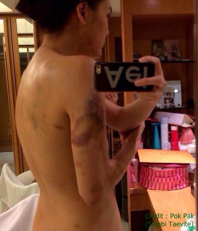 ภาพต้นฉบับมาดามเจนี่ โดนทำร้ายจากสามี