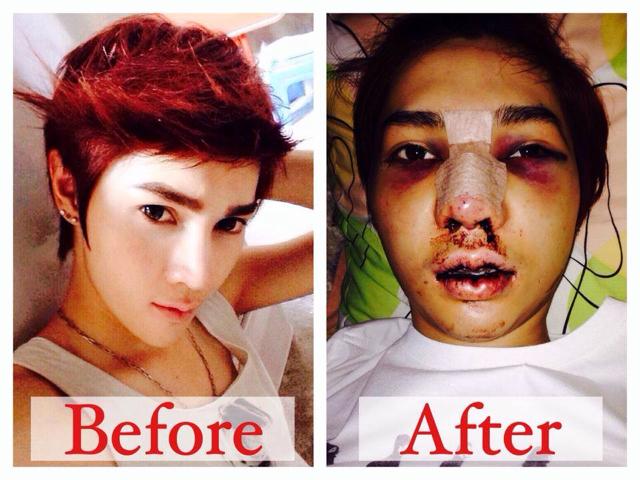 หน้าพัง ศัลยกรรมเฉียดแสด จริงเหรอ!!!!!