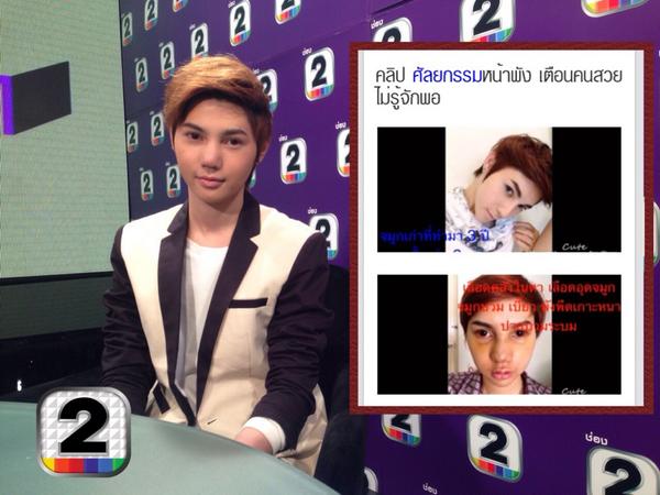 หน้าพัง ศัลยกรรมเฉียดแสด จริงเหรอ!!!!!