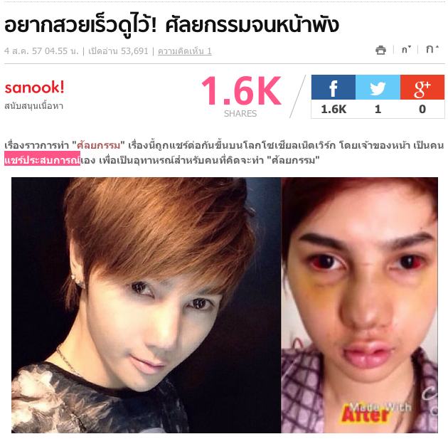 หน้าพัง ศัลยกรรมเฉียดแสด จริงเหรอ!!!!!
