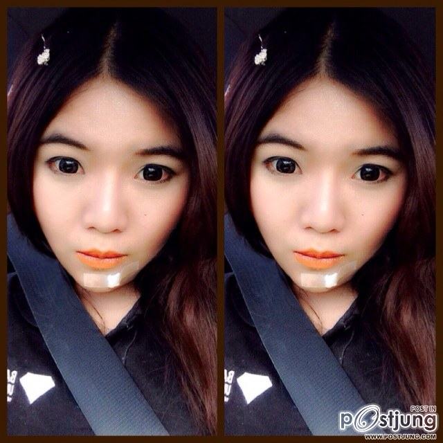 ขนาดเป็นแผลยังน่ารัก