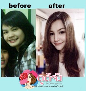 สวยหล่อไม่ต้องรอชาติหน้า