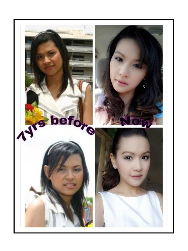 สวยหล่อไม่ต้องรอชาติหน้า