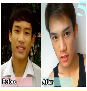 สวยหล่อไม่ต้องรอชาติหน้า