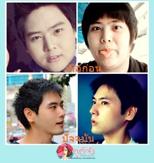 สวยหล่อไม่ต้องรอชาติหน้า