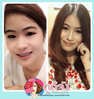 สวยหล่อไม่ต้องรอชาติหน้า
