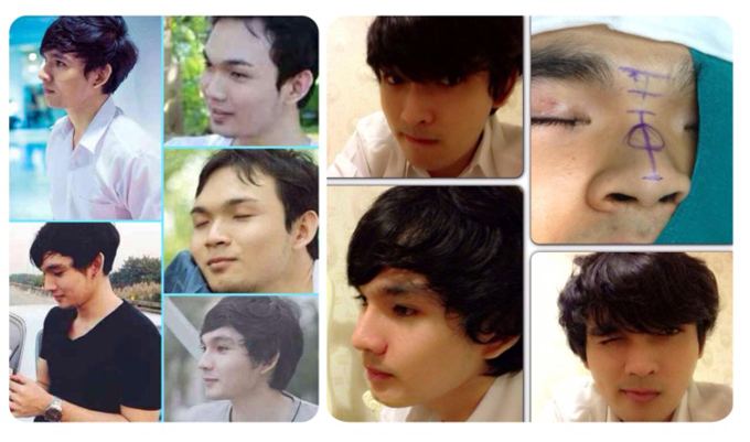 สวยหล่อไม่ต้องรอชาติหน้า
