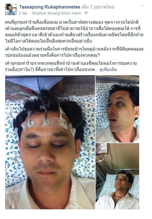 ฉาวอีกแล้ว แพมแพม ดาราดังช่อง3 ยกพวกกระทืบเพื่อนบ้าน สมองบวม