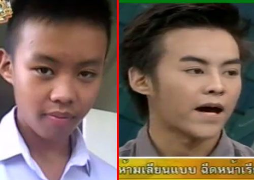 ศัลยกรรมแล้วดูดีมากๆ