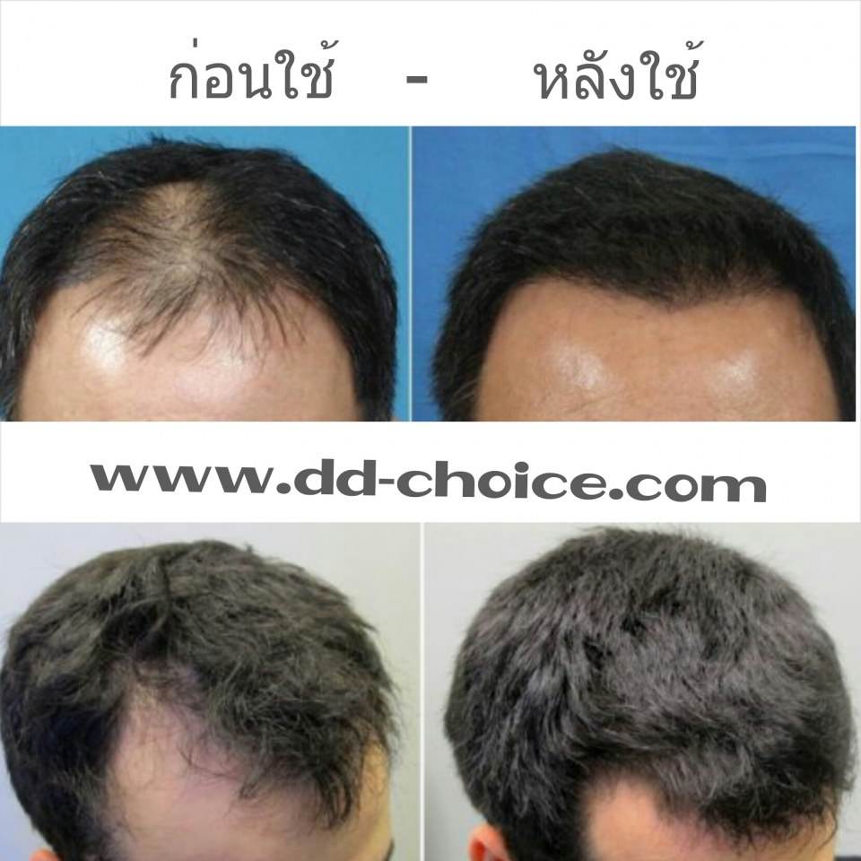 สมัยนี้มีอะไรอีกไหมที่ทำไม่ได้