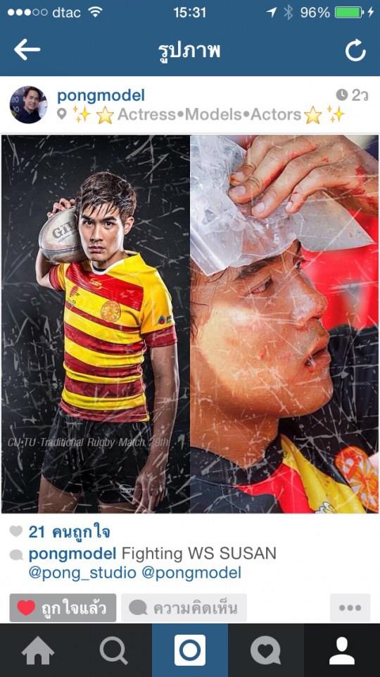 โป้งโมเดล