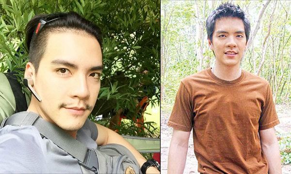 นิว วงศกร พระเอกหนุ่มหน้าหล่อ ก็ยอมรับเช่นกันครับว่าไปทำศัลยกรรมตามา ส่วนสาเหตุที่ต้องไปทำนั้นก็เพราะ ตาทั้งสองข้างไม่เท่ากัน นั่นเอง