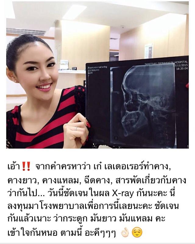 ไม่ได้ทำคาง !!! เก๋ เลเดอเรอร์ งัดหลักฐานโชว์ชัดๆเต็มๆ