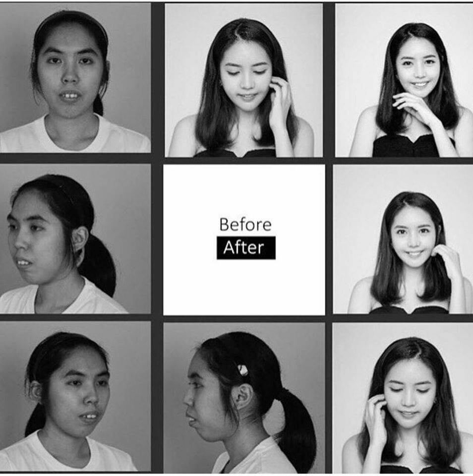 สวยจนตะลึง!!! "หลิน วงศ์ตะวัน" สาวศัลยกรรมพลิกชีวิต Let Me In Thailand คนแรกของประเทศไทย