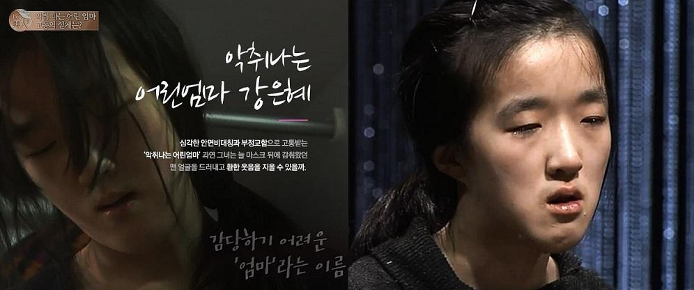 LET ME IN : แปลงโฉม คังอึนฮเย คุณแม่วัยทีนลูก 2 ที่มีเนื้องอกในปาก กลิ่นปากเหม็น จนสามีต้องขอเลิก