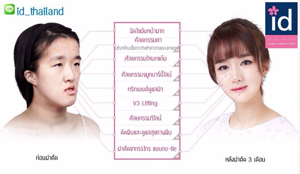 LET ME IN : แปลงโฉม คังอึนฮเย คุณแม่วัยทีนลูก 2 ที่มีเนื้องอกในปาก กลิ่นปากเหม็น จนสามีต้องขอเลิก