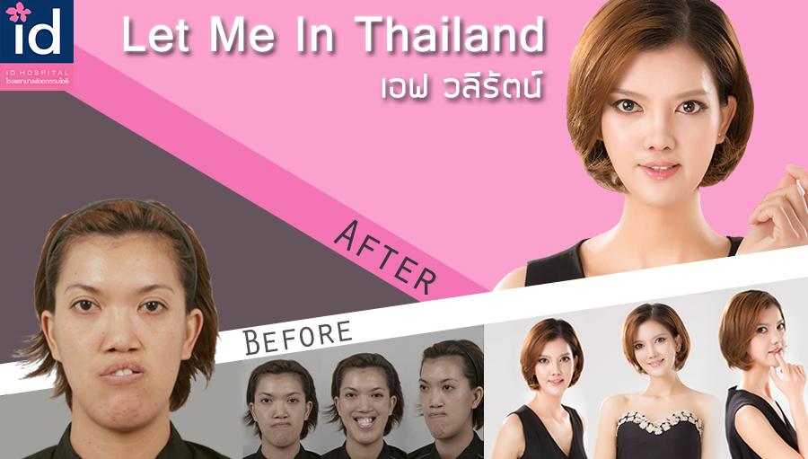 เอฟ วลีรัตน์ Let Me In Thailand โรงพยาบาลไอดี