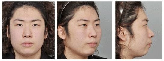 LET ME IN : โรงพยาบาลไอดี คุณหมอปาร์ค~amazing makeover!