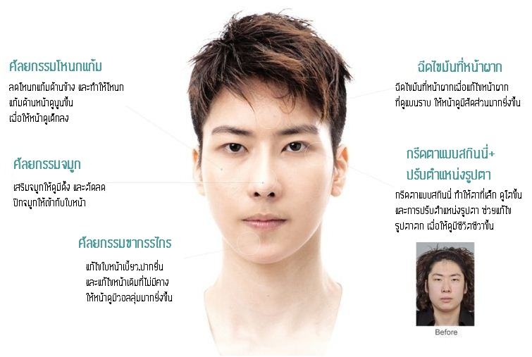LET ME IN : โรงพยาบาลไอดี คุณหมอปาร์ค~amazing makeover!