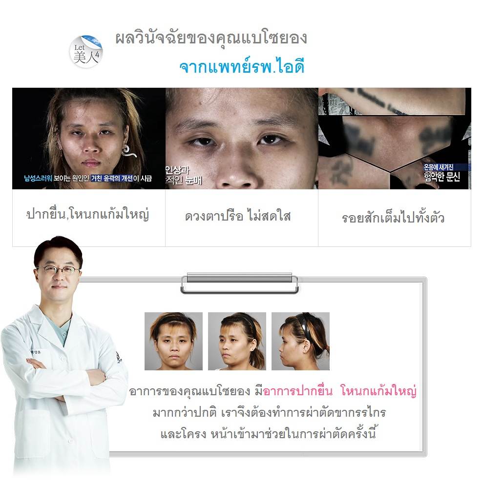 let me in โรงพยาบาลไอดี
