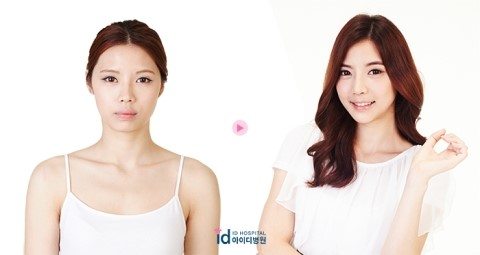 ดาราเกาหลี : ทำศัลยกรรมขากรรไกรปากยื่นที่ รพ.ไอดีเกาหลี