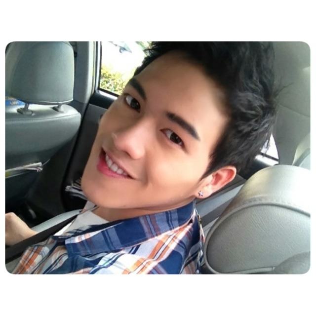 อาร์ม KPN ก่อนและหลังศัลยกรรม