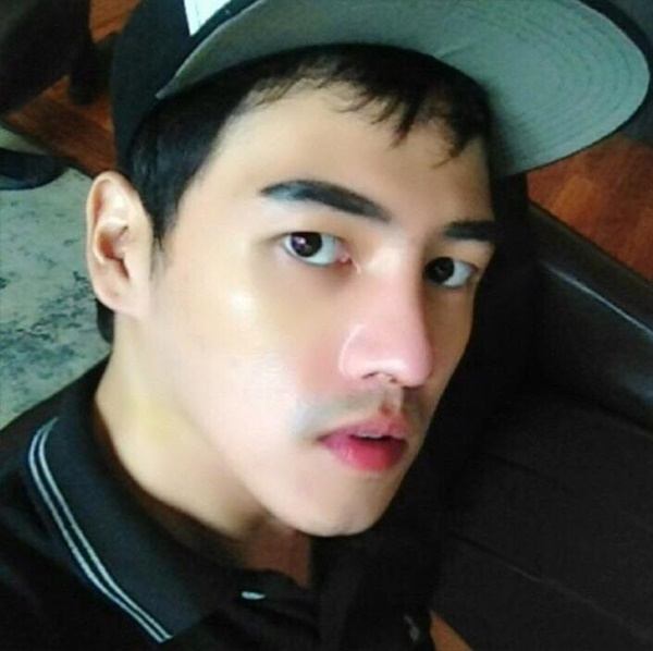 อาร์ม KPN ก่อนและหลังศัลยกรรม