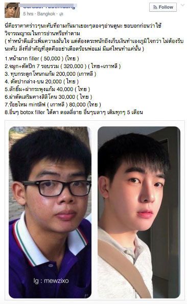 พลิกชีวิต มิว สุรเดช หนุ่มไทยจากหน้าตาบ้าน สู่ความหล่อระดับโอปป้า !