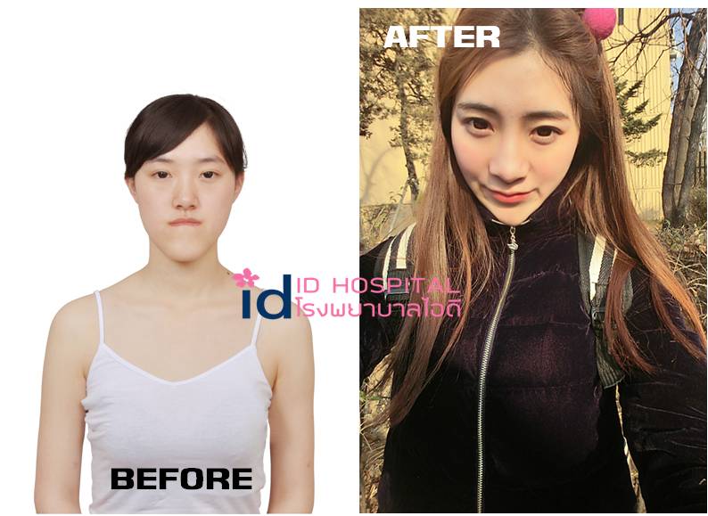 หนุ่มสาวแดนกิมจิพลิกชีวิตทำหน้าจนเปลี่ยนไปเลย!