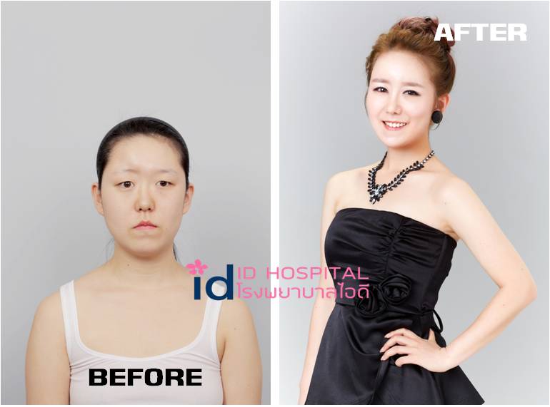 หนุ่มสาวแดนกิมจิพลิกชีวิตทำหน้าจนเปลี่ยนไปเลย!