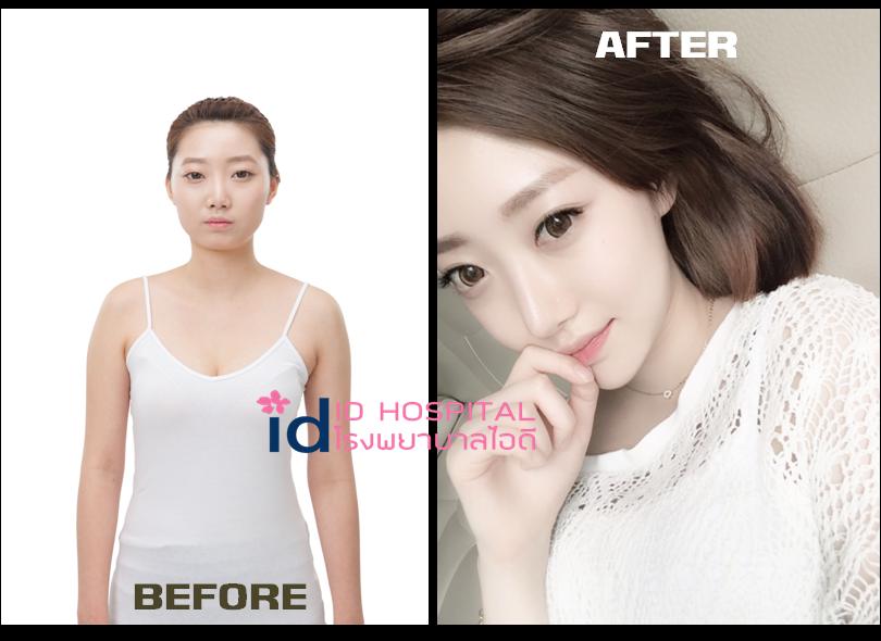 หนุ่มสาวแดนกิมจิพลิกชีวิตทำหน้าจนเปลี่ยนไปเลย!