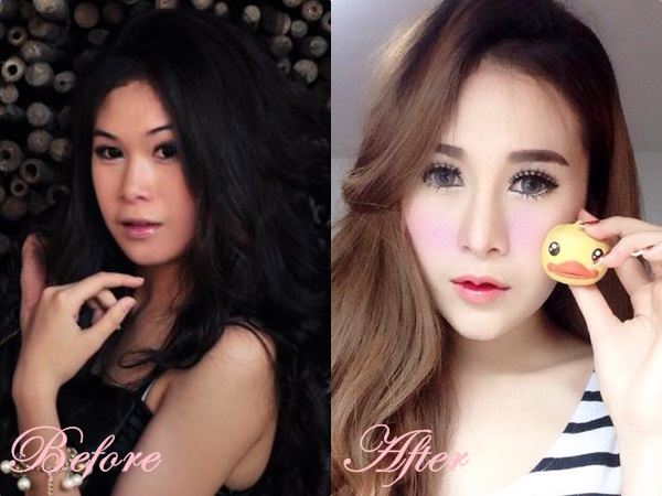 จากลูกเป็ดขี้เหล่