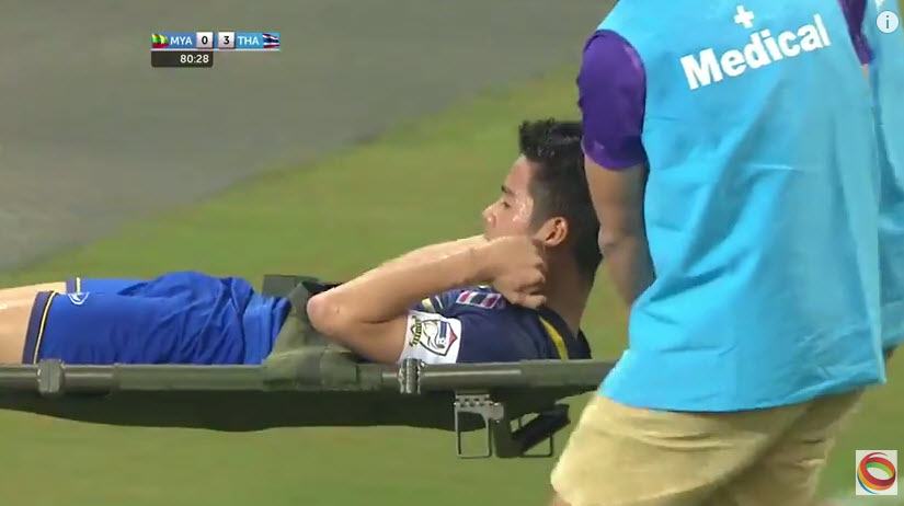 นักบอล "เป้าตุง"