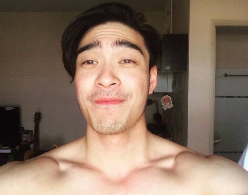 แพ้ทาง"หนวด ขน"