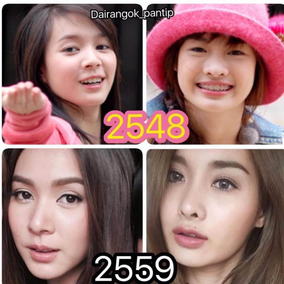 จากอดีตสู่ปัจจุบัน ซุปตาร์ สุด hot ของเมืองไทย