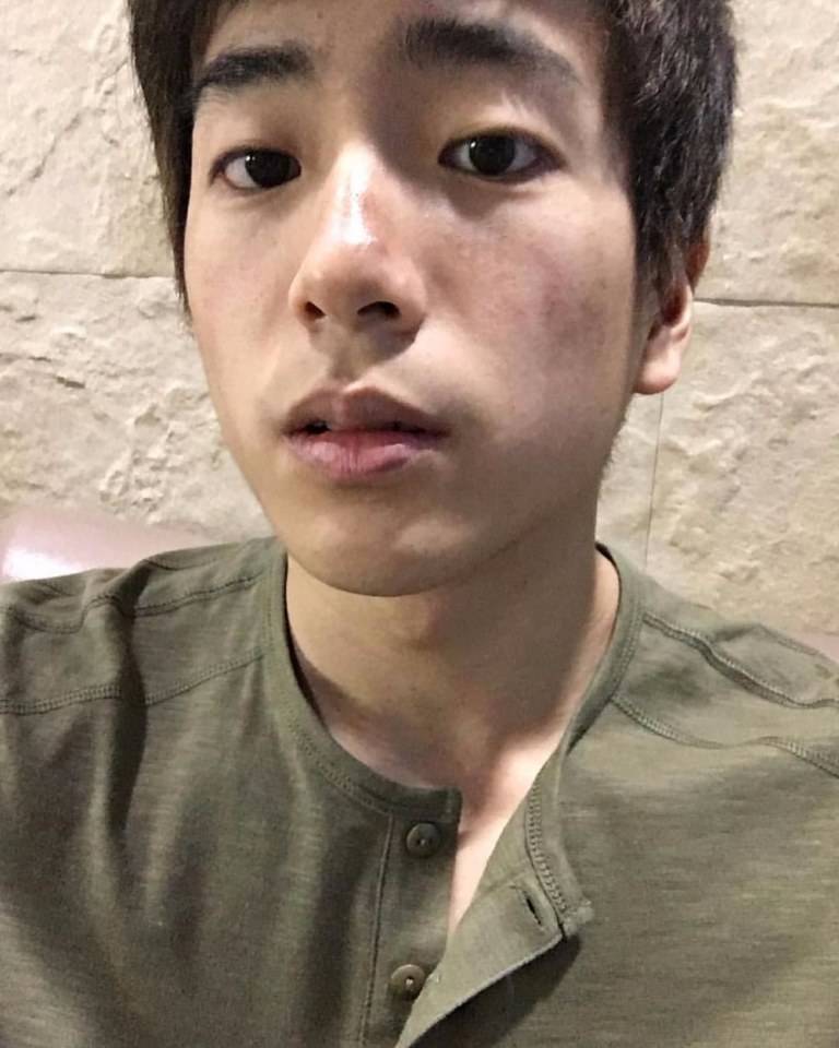นนท์ น่ารักจุง