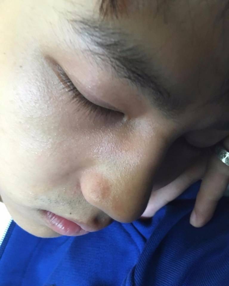 นนท์ น่ารักจุง