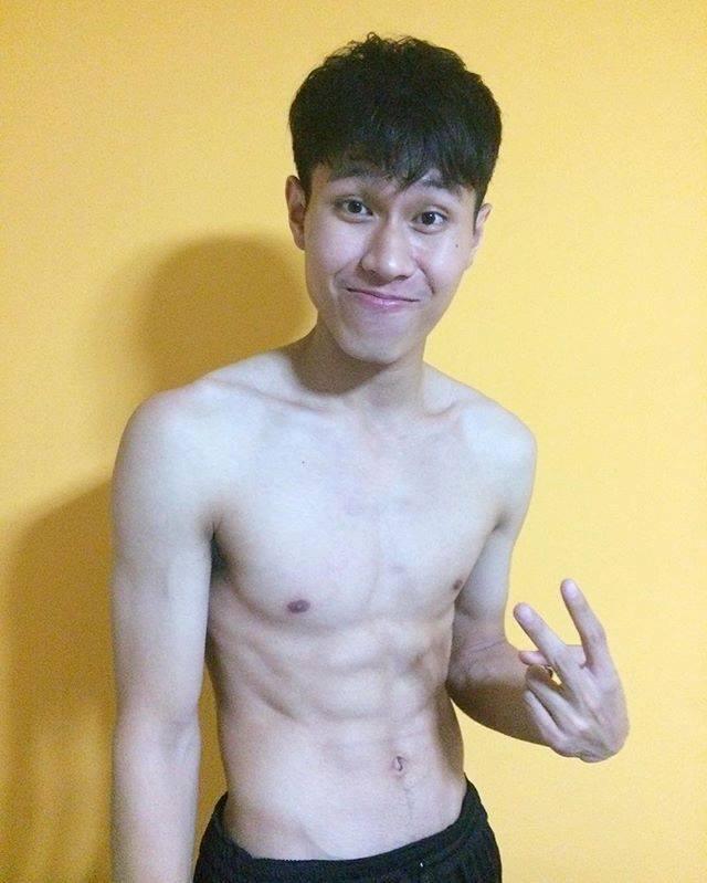 แพ้ความขาว 1,919