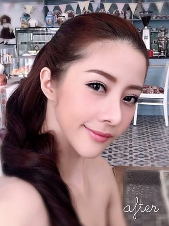 ของแท้หรือปลอม..ศัลฯหรือไม่ศัลฯ ส่อง20ดาราไทยตอนเข้าวงการใหม่ๆกับปัจจุบัน #1