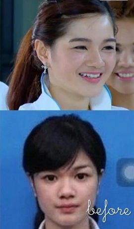 ของแท้หรือปลอม..ศัลฯหรือไม่ศัลฯ ส่อง20ดาราไทยตอนเข้าวงการใหม่ๆกับปัจจุบัน #1