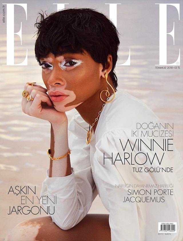 Winnie Harlow @ ELLE Turkey July 2018