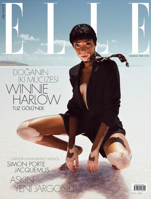 Winnie Harlow @ ELLE Turkey July 2018