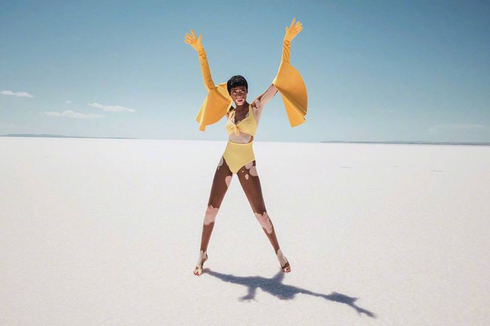 Winnie Harlow @ ELLE Turkey July 2018