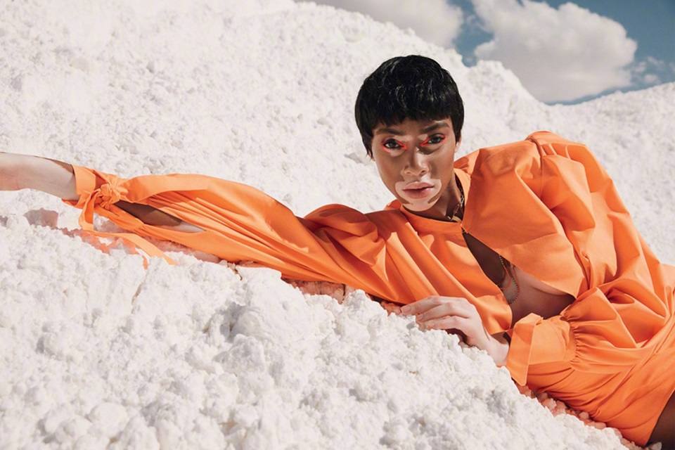 Winnie Harlow @ ELLE Turkey July 2018