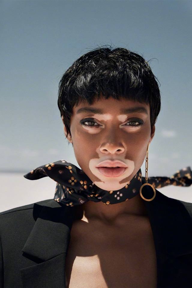 Winnie Harlow @ ELLE Turkey July 2018