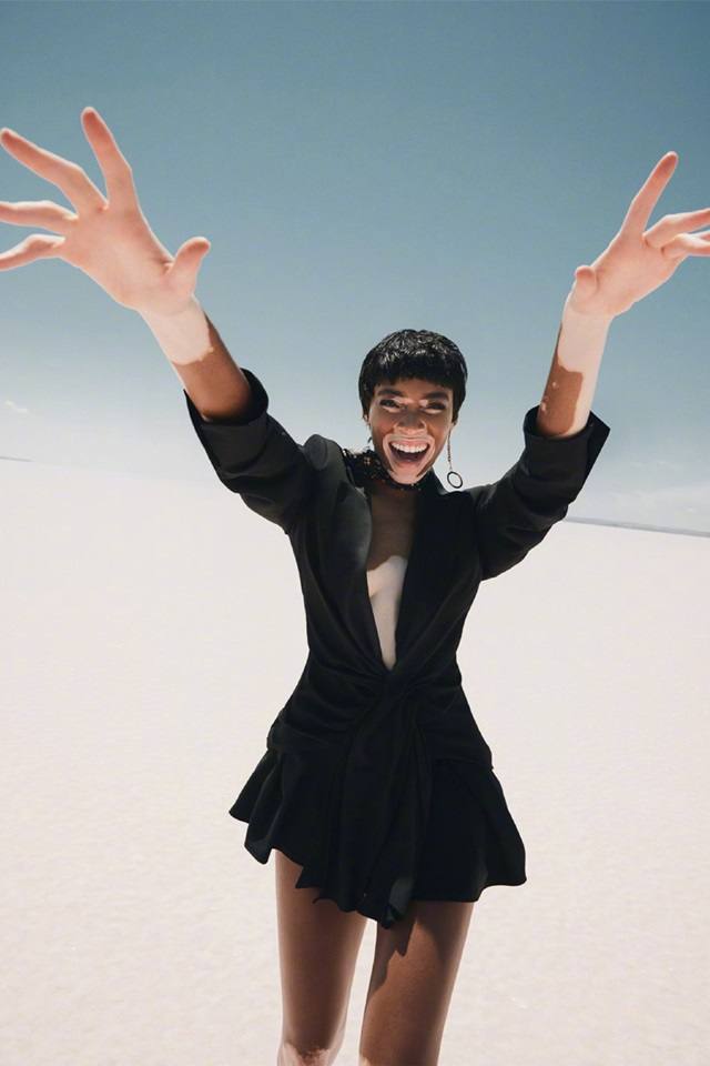 Winnie Harlow @ ELLE Turkey July 2018